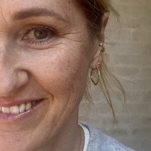 Ørering, Twisted Heart